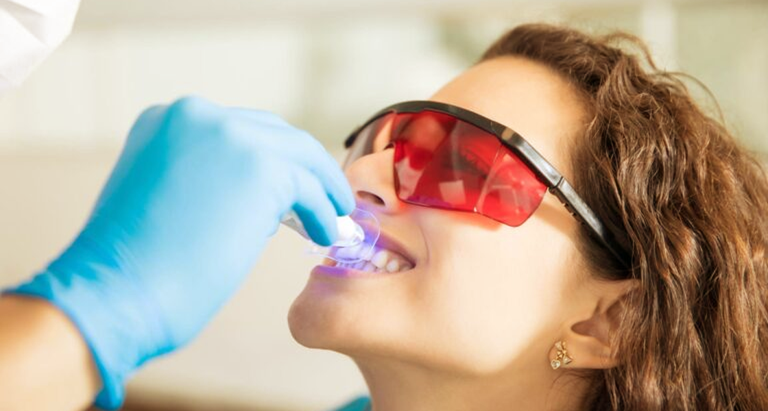 Prótese Dentária sobre implante em Itaipu – Dra. Simone Paez.