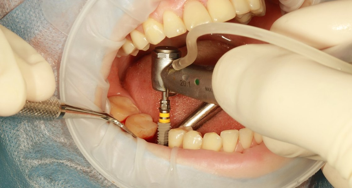 Dentista em Icaraí Niteroi – Costa Souza Odontologia.