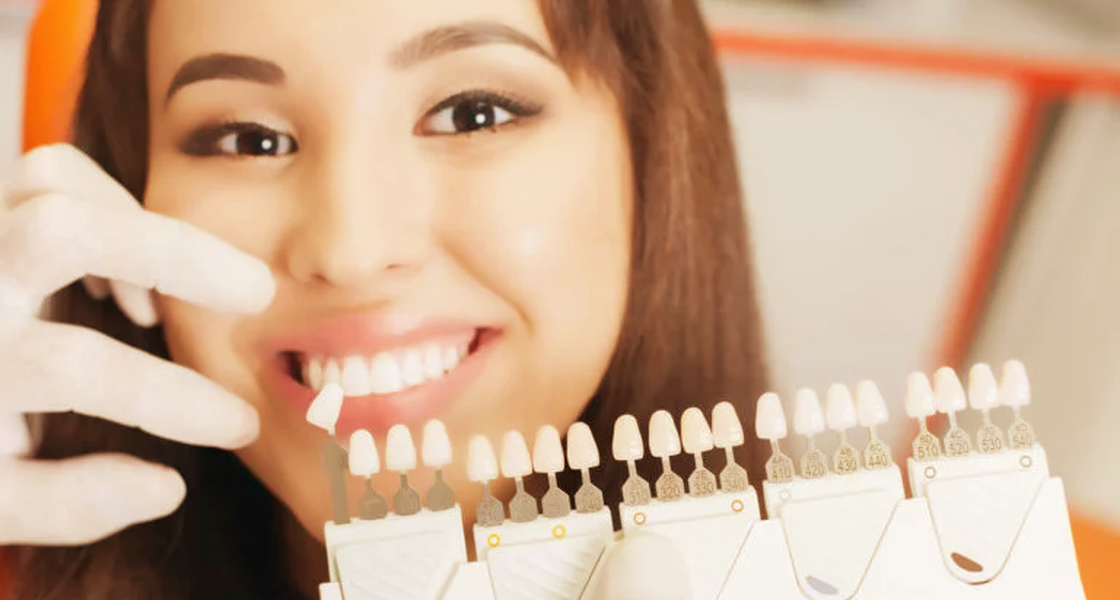 Lente de Contato dental em Icaraí – Costa Souza Odontologia.